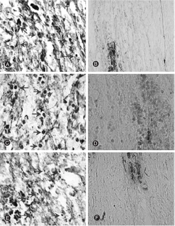 Fig. 1. Identification of hUCB in compressed spinal cord immunohistochemical stained with mouse anti-human mitochondria mono- mono-clonal antibody (MAB1273)