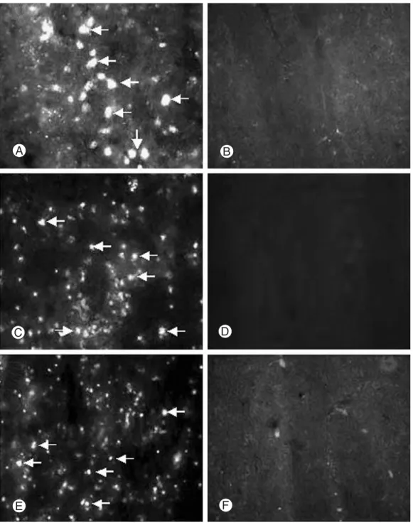 Fig. 2. Identification of the hUCB in compressed spinal cord. hUCB, prelabeled with FITC-conjugated cholera toxin, were injected into the tail vein 1, 3, 5 days after compression injury