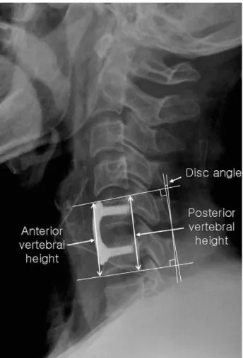 Fig. 1. Radiograph showing linear and angular measurement.