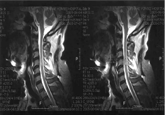 Table 4. T-spine Injury
