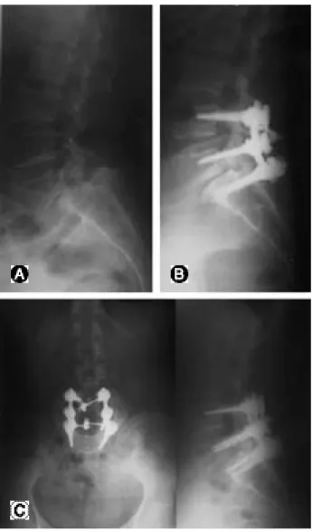 Table 5. Radiologic Finding