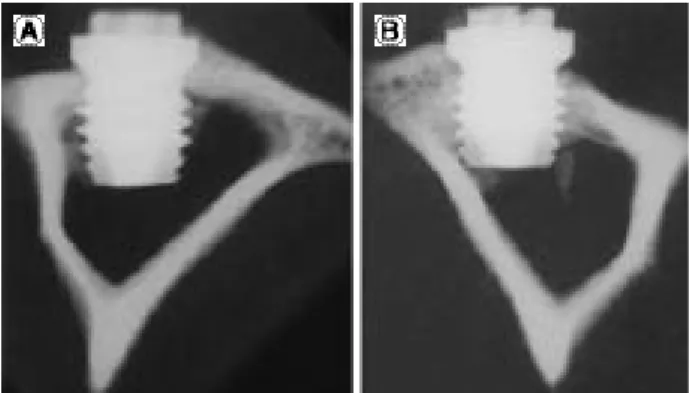 Fig. 5. The uncoated implant insertion in the tibia at 12 weeks.