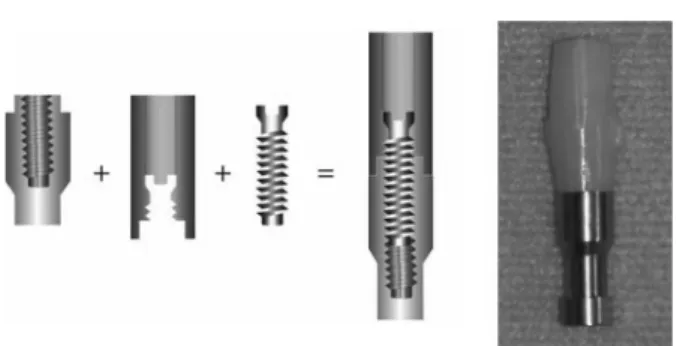 Fig. 1. The system of abutment.