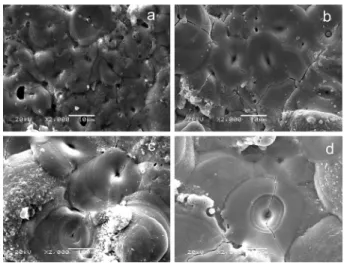 Fig. 3. Cross-sectional SEM micrographs of the oxide layers prepared in different times of (a) 5 min, (b) 10 min, (c) 15 min, (d) 30 min, (e) 60 min.