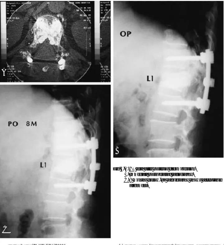Fig. 1-B. Immediate postoperative radiography.