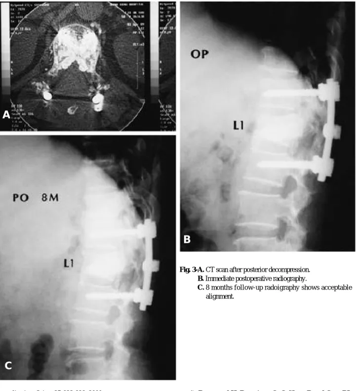 Fig. 1-B. Immediate postoperative radiography.