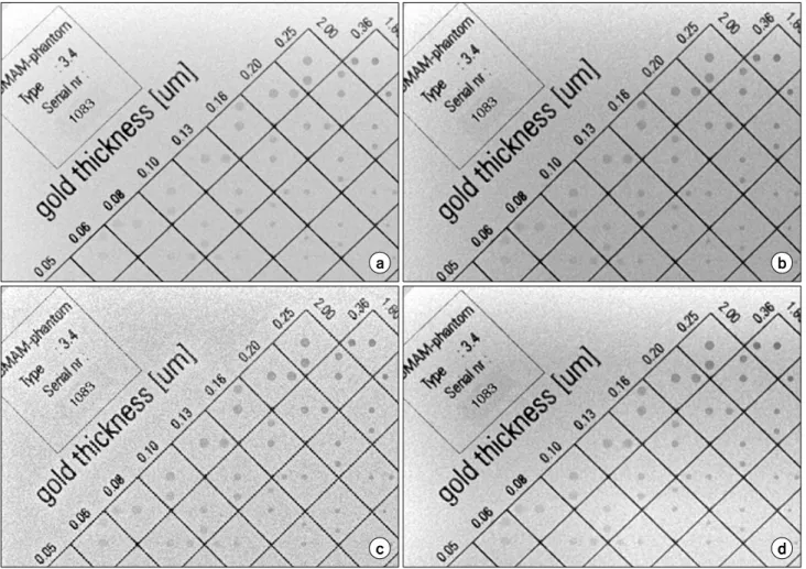 Fig.  2.  Comparison  of  images  of  original  (a)  and  proposed  method  where  gamma  correction  (b),  MUSICA  (c),  CLAHE  (d)  were  applied  on  the  wavelet  basis  with  sigmoid  function  applied  on  wavelet  coefficients.
