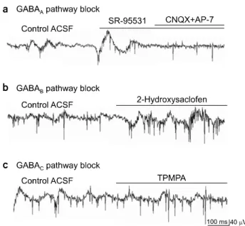 Fig.  5.  Effects  of  specific  GABAergic  synapse  blocking.  (a)  When  treated  with  specific  GABA A   blocker,  SR-95531,  the  amplitude  of  the  slow  wave  component  increased