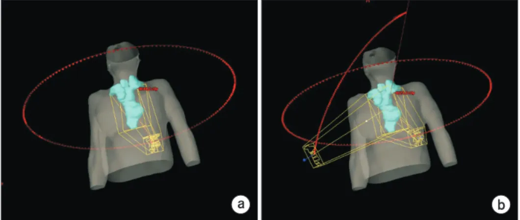 Fig. 2. Arc beam geometry com- com-parison for coplanar (a) and  non-coplanar (b) volumetric modulated  arc therapy (VMAT) plans.