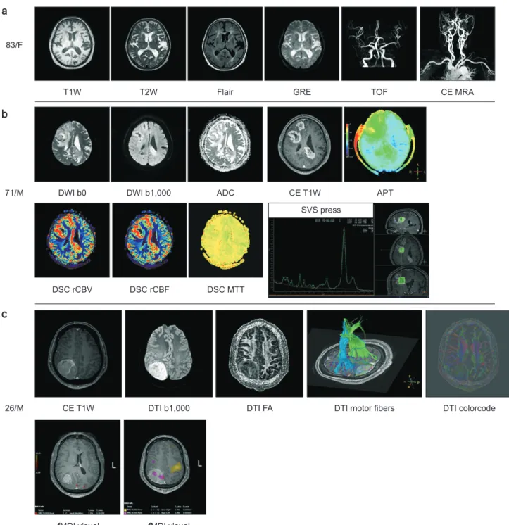 Fig. 2. Patient cases to show imaging contrasts acquired from (a) 83-year-old female, (b) 71-year-old male, and (c) 26-year-old male using a  3 T MRI system
