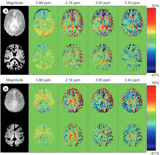 Fig. 2. Representative magnetization transfer ratio asymmetry (MTR asym ) maps acquired at four different offset frequencies and the  corresponding reference image obtained without (top) and with (bottom) masking the cerebrospinal fluid (CSF) signals of th