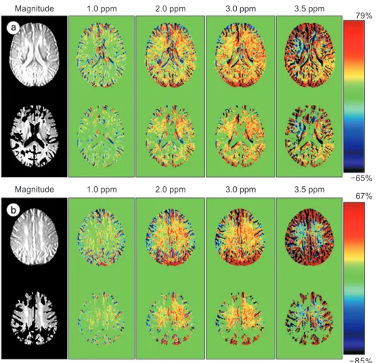 Fig. 2 shows the representative MTR asym  maps acquired  at four offset frequencies with the 3D-segmented  gradient-echo EPI sequence