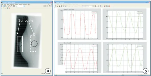 Fig. 2. (a) In-house motion analysis  soft ware and (b) the result of motion  an alysis for whole-breast irradiation