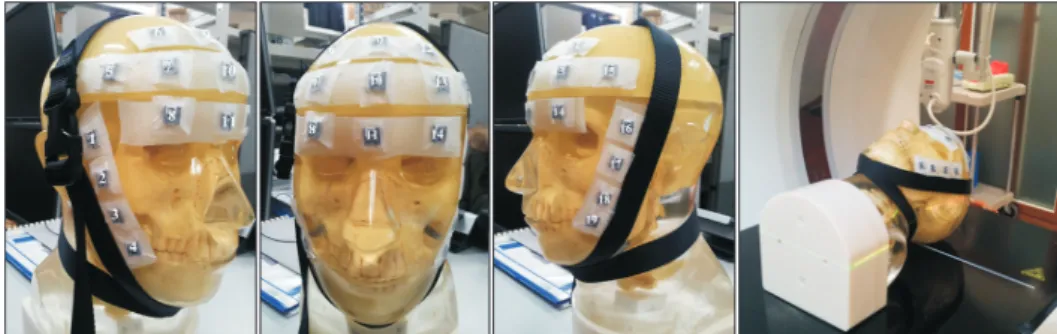 Fig. 1. Nineteen OSLDs attached on  the surface of a head-and-neck  phan-tom.