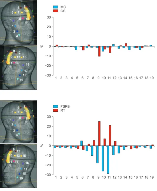 Fig. 4. Comparison of the dose dif- dif-ference between calculated and  mea-sured values in 19 OSLDs using MC  and CS.MCCS13020100102030%23456789 10 11 12 13 14 15 16 17 18 19