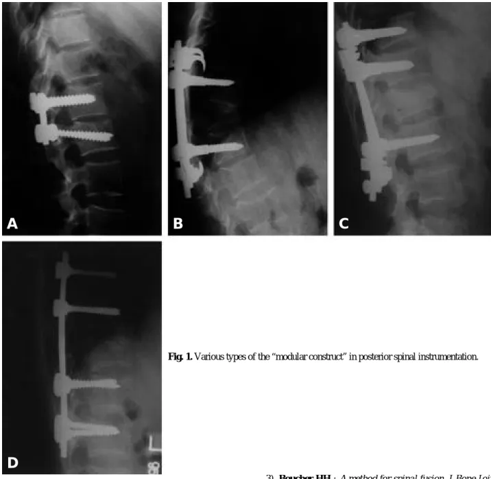 Fig. 1. Various types of the “modular construct” in posterior spinal instrumentation.