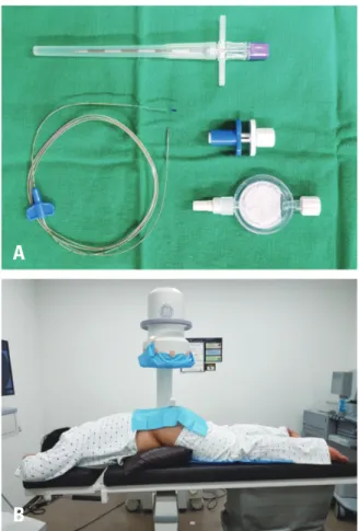 Fig. 1. (A) Caudal catheter (EPINA PLUS, Ace Medical. Seoul, Korea). (B)  The patient’s position during a caudal epidural injection with a catheter.