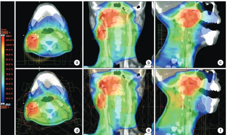 Fig. 2. A representative patient’s dose volume histograms (DVHs)  for the head and neck case are shown