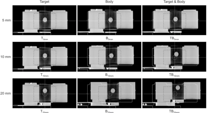 Fig. 1. The CBCT images according to target and phantom movement. Red solid line and blue dashed line indicate the target ROI and  CBCT gamma ROI, respectively.