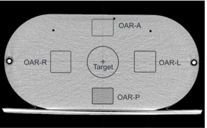 Table 2. Dose constraints in the optimization process of the IMRT  planning.