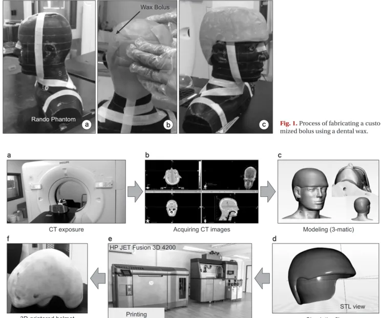 Fig. 2. Process of fabricating a customized bolus using a 3D printer (HP JET Fusion 3D 4200) after modelling through 3-matic ® (Materialise, Leuven, Belgium) from CT images of a RANDO phantom.