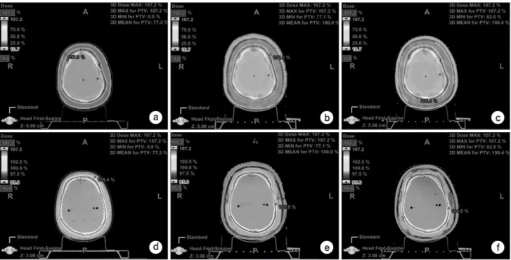 Fig. 3a shows the only RANDO phantom without use of  the bolus helmet. Fig. 3b shows the image of the helmet  fabricated with wax bolus placed onto the RANDO  phantom, and Fig