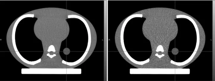 Fig. 3. 4D CT images of the lung phantom acquired using the default scan parameter (600 mAs) without iDose (left) and the low dose scan  parameter (200 mAs) with iDose (right).