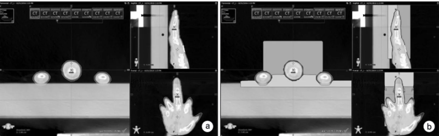 Fig. 1. Design procedure of the 3D virtual bolus in TPS. (a) The contour is delineated with 2 mm expansion from the body structure, (b)  the virtual bolus is designed as a box shape which cover the treatment lesion and exclude the contour drawn previously 