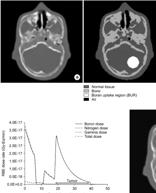 Fig.  2.  Creating  the  voxel  model  from  the  patients’  CT  image  for  dose  calculation