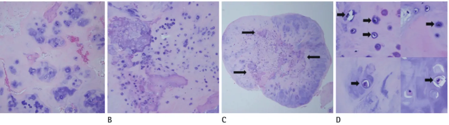 Fig. 3. Histopathologic findings of the cervical mass lesions.