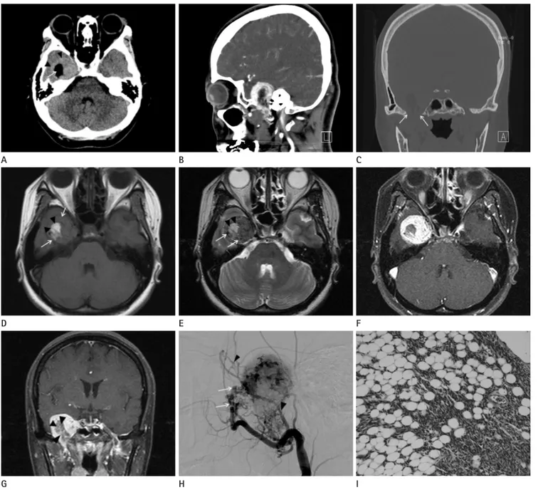 Fig. 1. A 44-year-old woman who presented with 1 month history of dizziness.