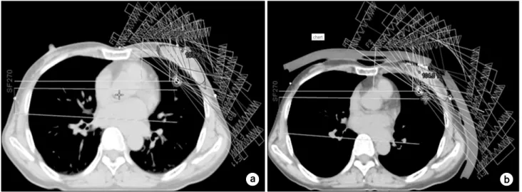 Fig.  1.  Breast  intensity-modulated  radiation  therapy  (IMRT)  plan:  (a)  axial  dose  distribution  of  the  breast  IMRT  plan  without  bolus,  (b)  axial  dose  distribution  of  the  breast  IMRT  plan  with  bolus.