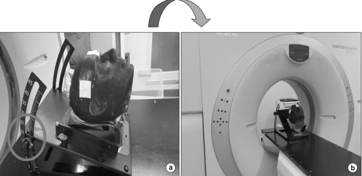 Fig.  1.  (a)  RANDO  Phantom  and  head-board,  (b)  RANDO  Phantom  and  head-board  scan  with  CT  simulator.