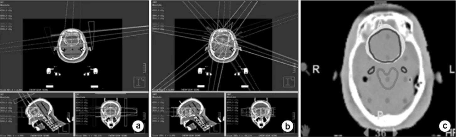 Fig.  3.  Dose  distribution  among  the  3  different  treatment  techniques  (a)  3D-CRT,  (b)  Linac-IMRT  and  (c)  Tomotherapy.