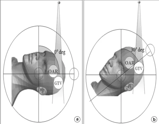 Fig.  5.  Difference  of  received    dose  of  OAR  among  the  tilting  angle.  (a)  0  degree,  (b)  30  degree.
