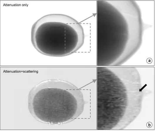 Fig.  10.  Comparison  of  the  image  characteristics  between  (a)  the  attenuation-only  image  and  (b)  the  fusion  image  (i.e.,  the   atte-nuation＋the  scattering)  in  Fig