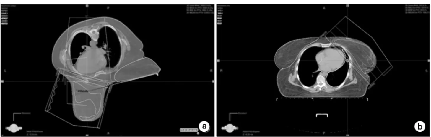 Fig.  2.  CT  image  of  the  patient;  (a)  Prone  (b)  Supine.