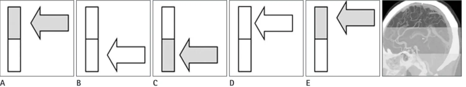 Fig. 1. Toggling table technique. 