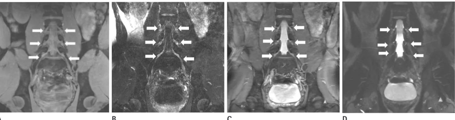 Fig. 1. Coronal reformatted images of four different sequences of 29-year-old healthy male
