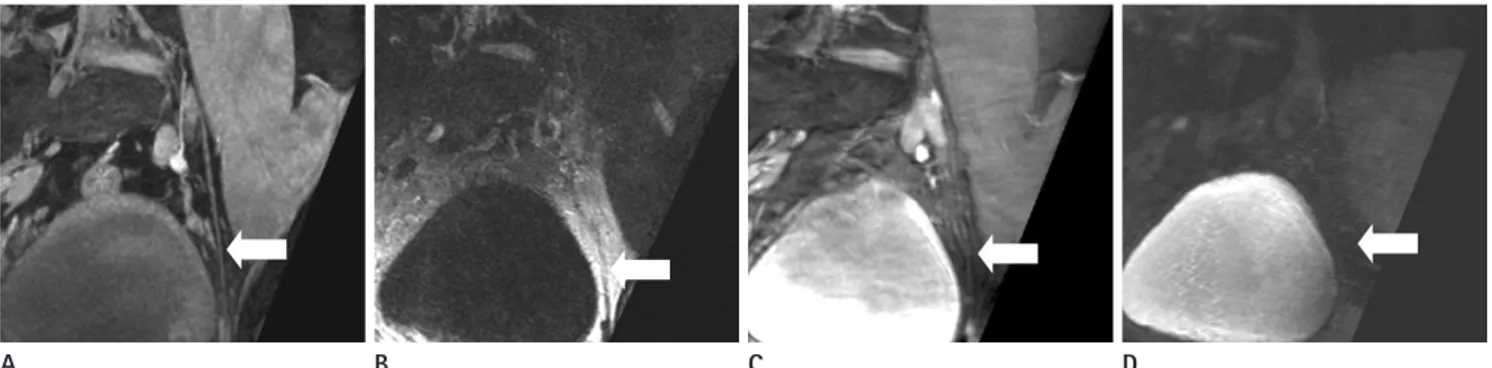 Fig. 5. Oblique sagittal reformatted images of four different sequences of 28-year-old healthy male