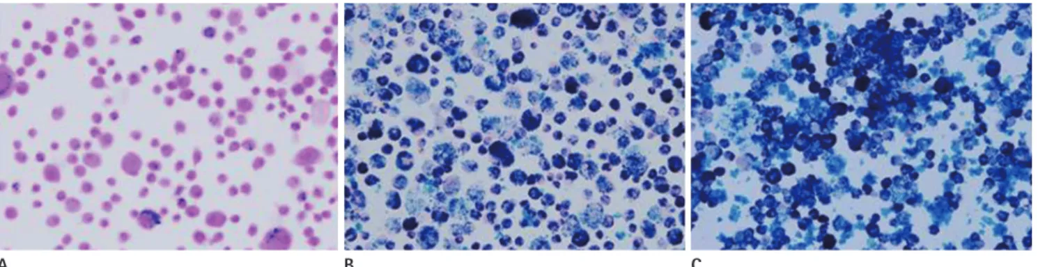 Fig. 1. Photomicrographs of Prussian blue stained labeled hMSCs with different molecular weight PLLs