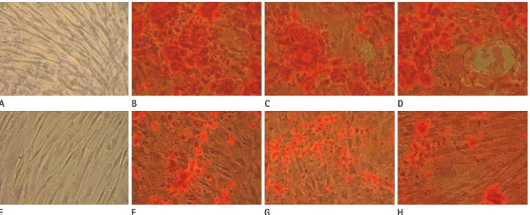 Fig. 7. Photomicrographs showing the results of osteogenic induction of hMSCs immediately (A-D) and 4-days (E-H) after labeling by the  SPIO-PS (C, G) and the SPIO-PLL (D, H) complexes