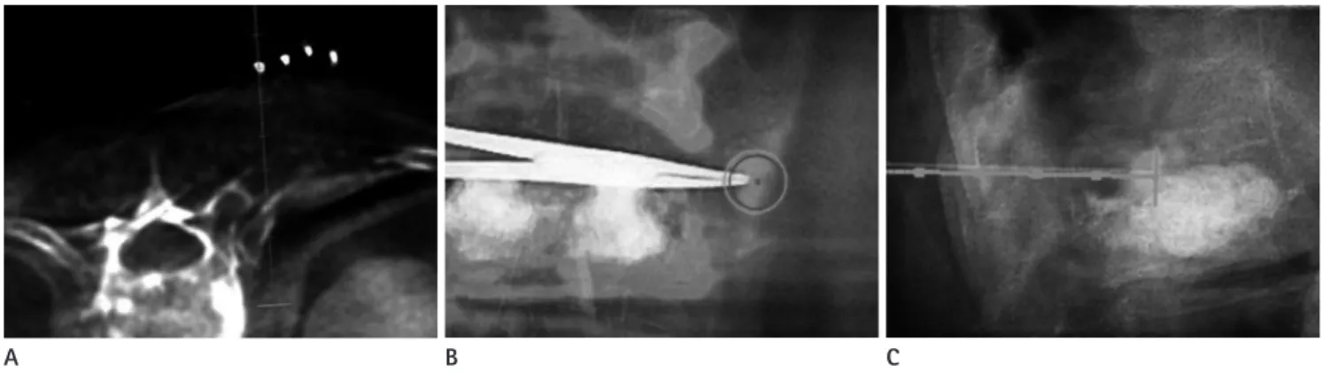 Fig. 1. Image-guided needle procedure.