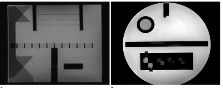 Fig. 2. Sagittal localizer (A) and axial image (B) of a MR phantom on T1-weighted sequence (TR/TE/ETL 500/20/1).
