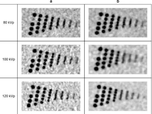 Fig.  4.  Spatial  resolutions  of  hole  pattern  with  (a).  Filtered  back  projection  (FBP)  and  (b)