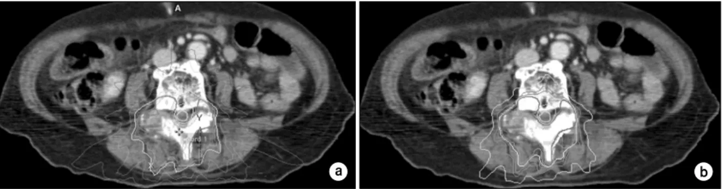 Fig.  1.  The  isodose  distributions  for  the  center  slice  of  the  CT  data.  (a)  dose  distributions  from  iPLan,  (b)  dose  distributions  in  this  study.