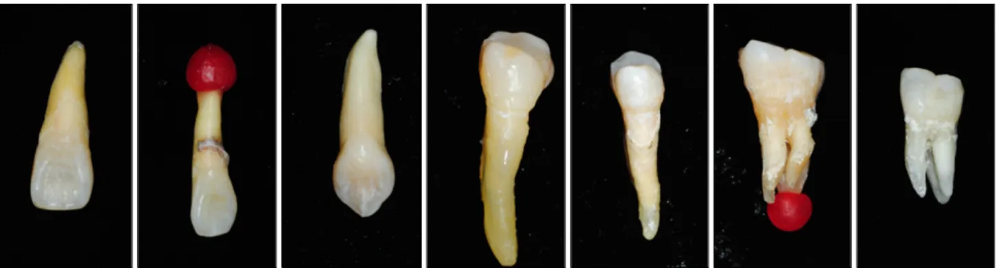 Fig.  1.  Seven  tooth  phantoms:  all  contain  cavities  inside. 선 영상에서 주어진 정보는 다른 치아 우식증 검출 시스템 들과 마찬가지로 노이즈와 영상외곡을 포함한 다양한 입력 정보로 얽혀져 있기 때문에(Convoluted  image)  올바른 진단을 위해 필요한 치아 정보를 얻기 위해서는 결국 영상 분석이라는 과정이 요구된다