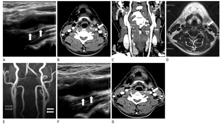 Fig. 1. A 49-year-old man with left neck pain with tenderness.