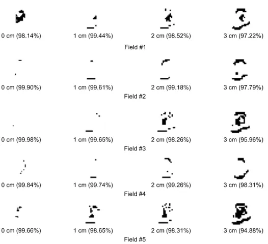 Fig.  2.  Example  of  five  respiratory  gated  IMRT  fields  for  case  of  A  patient;  the  phantom  simulated   re-spiratory  motion  with  four  scenario  (0,  1,  2,  and  3  cm  motion  range  and  3.6  s  cycle)