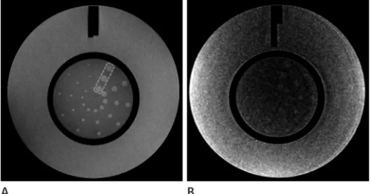 Fig. 2. Low-contrast object detectability in phantom test.